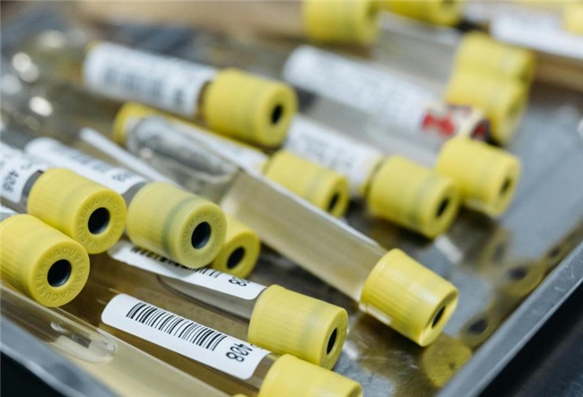 取痰难、检测慢？舌拭子分子检测技术 15 秒无创采样！